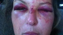 Martha Maclure brutalised while trying to protect 3 toddlers from their father