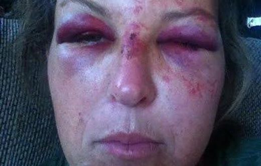 Martha Maclure brutalised while trying to protect 3 toddlers from their father