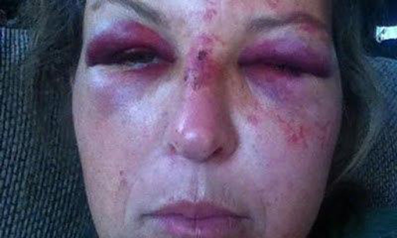 Martha Maclure brutalised while trying to protect 3 toddlers from their father