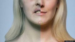 Effects of cigarette on the skin