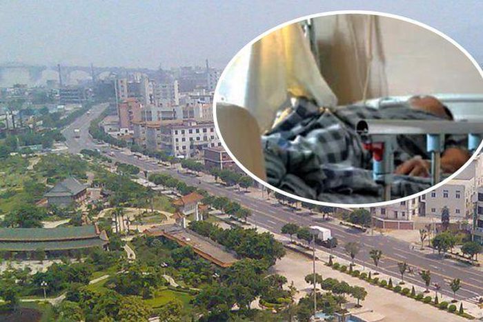 The 'demembered' man is currently receiving treatment at a local hospital.