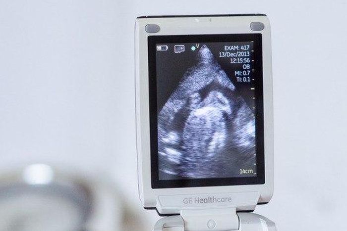 ___4231792___https:______static.pulse.com.gh___webservice___escenic___binary___4231792___2015___10___5___18___tumblr_inline_nm4hac2GNM1sgr685_540