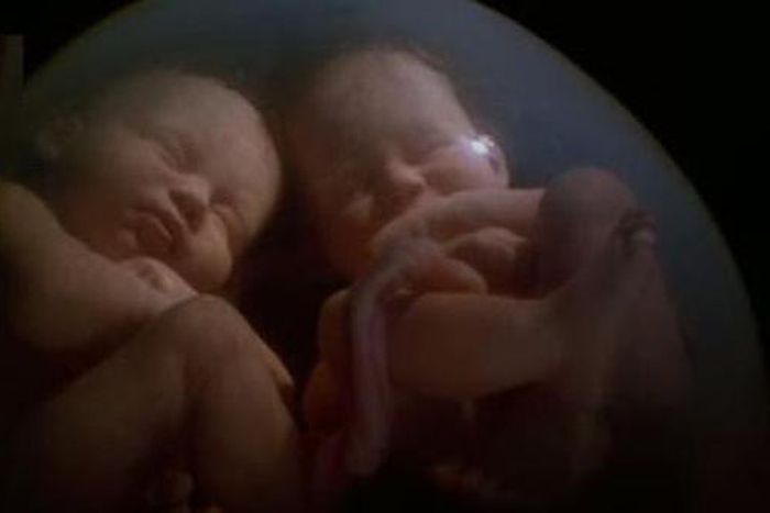 ___4167599___https:______static.pulse.com.gh___webservice___escenic___binary___4167599___2015___9___14___18___Babies+fight