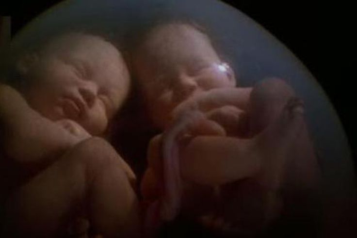 ___4167599___https:______static.pulse.com.gh___webservice___escenic___binary___4167599___2015___9___14___18___Babies+fight