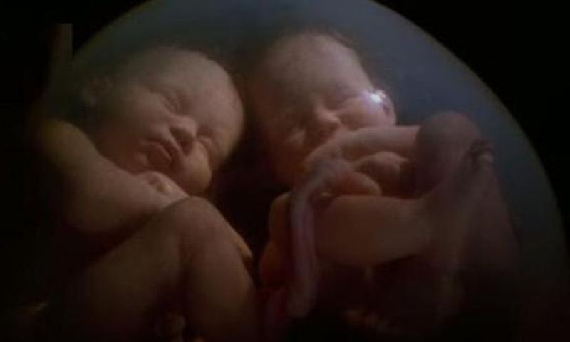 ___4167599___https:______static.pulse.com.gh___webservice___escenic___binary___4167599___2015___9___14___18___Babies+fight