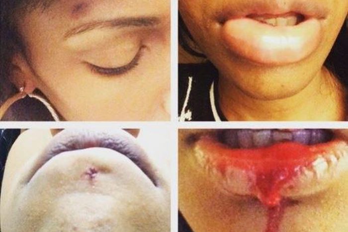 G-Unit rapper, Kidd Kidd's girlfriend's face after he allegedly beat her up