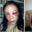 Summer Gregg was attacked, beaten and urinated on by friends for 8 hours