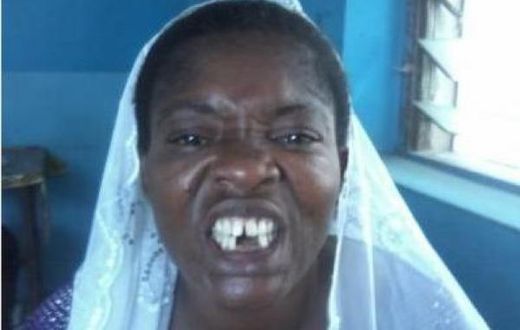 Man in court for allegedly beating up and removing a woman's teeth