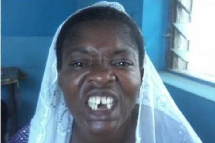 Man in court for allegedly beating up and removing a woman's teeth