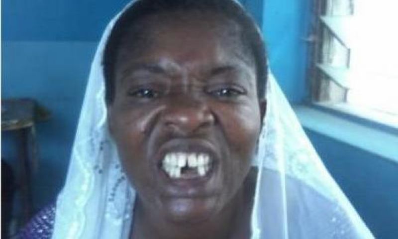 Man in court for allegedly beating up and removing a woman's teeth