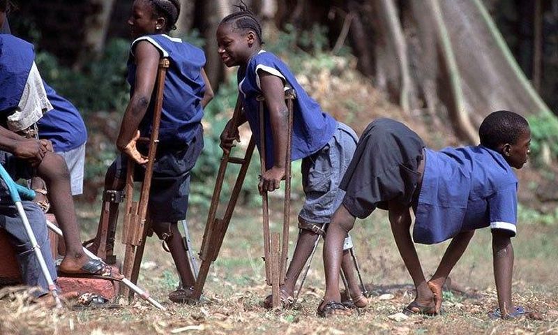 Poliomyelitis (polio) is a highly infectious viral disease, which mainly affects young children.