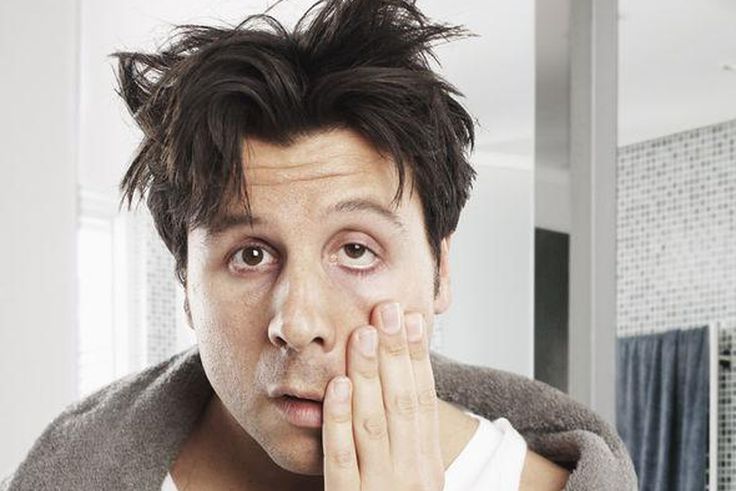 How to cure hangover