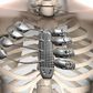 3D imagery showing the titanium rib cage in the patients body