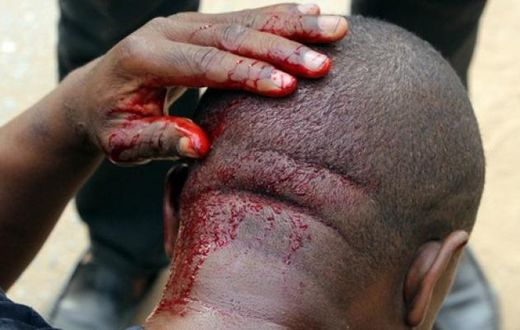 Seven injured