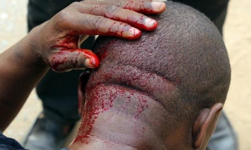 Seven injured