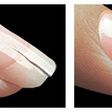Broken/cracked nails are common but they can be fixed
