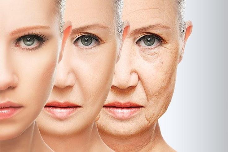 Aging