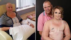 Cancer survivor, Alison Hawkes and husband, Ian Hawkes in a topless photoshoot