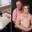 Cancer survivor, Alison Hawkes and husband, Ian Hawkes in a topless photoshoot
