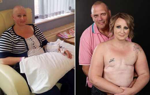 Cancer survivor, Alison Hawkes and husband, Ian Hawkes in a topless photoshoot