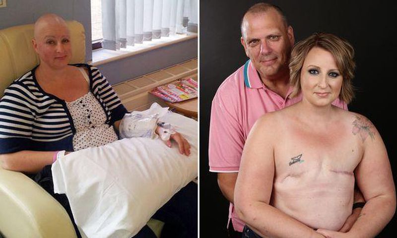 Cancer survivor, Alison Hawkes and husband, Ian Hawkes in a topless photoshoot
