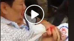 Chinese man involved in terrible accident refuses to leave his money bag (Video)