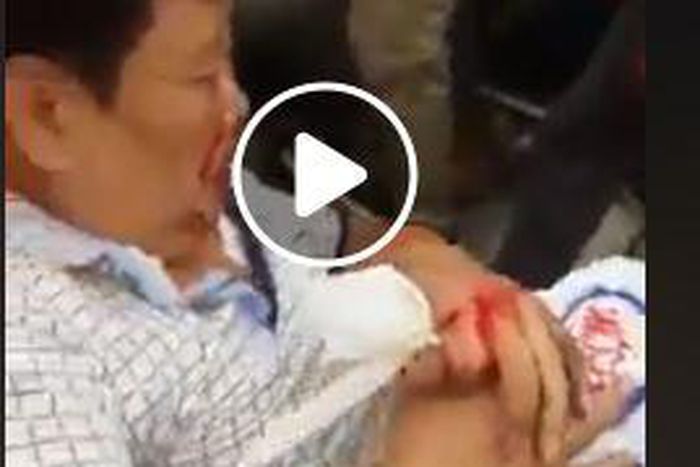 Chinese man involved in terrible accident refuses to leave his money bag (Video)