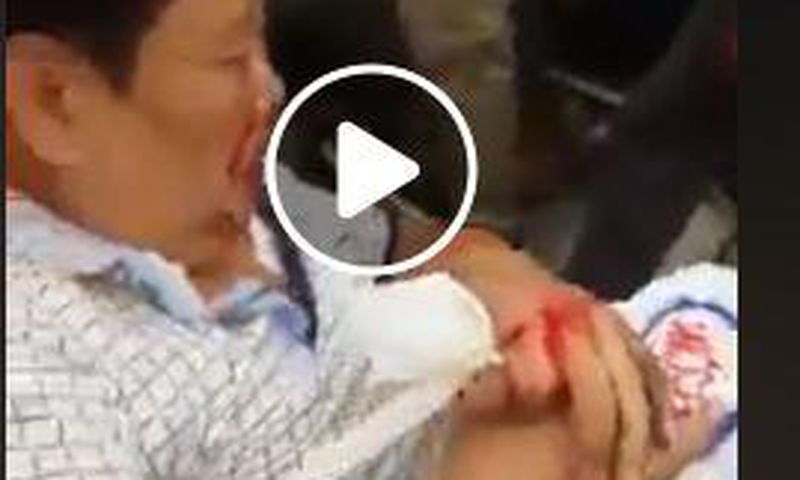 Chinese man involved in terrible accident refuses to leave his money bag (Video)