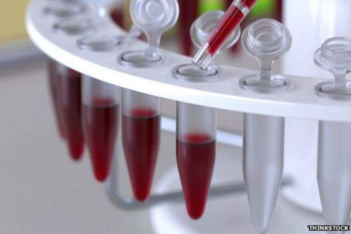 ___3727022___https:______static.pulse.com.gh___webservice___escenic___binary___3727022___2015___5___5___15____82679574_thinkstockphotos-484428385_1