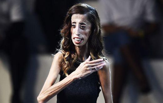 Lizzie Velasquez