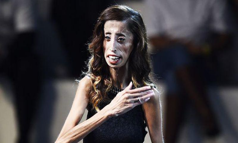 Lizzie Velasquez