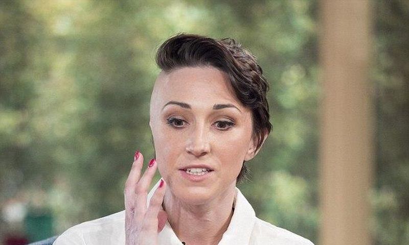 A beautician was disfigured in an acid attack orchestrated by her jealous ex-boyfriend.