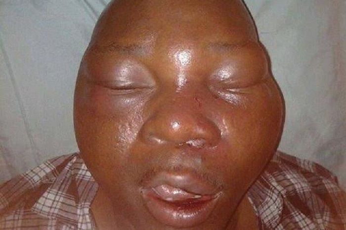 Yomi Olomofe's battered face
