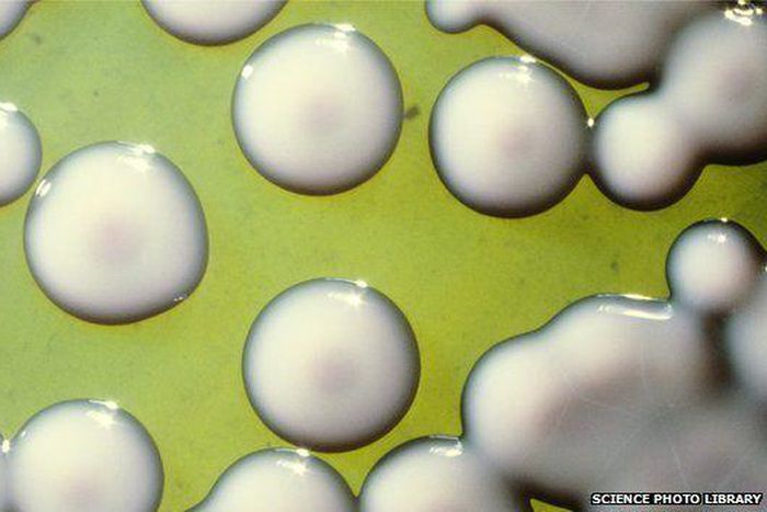 ___3744990___https:______static.pulse.com.gh___webservice___escenic___binary___3744990___2015___5___11___17____82916216_m8740594-cultured_typhoid_bacteria-spl