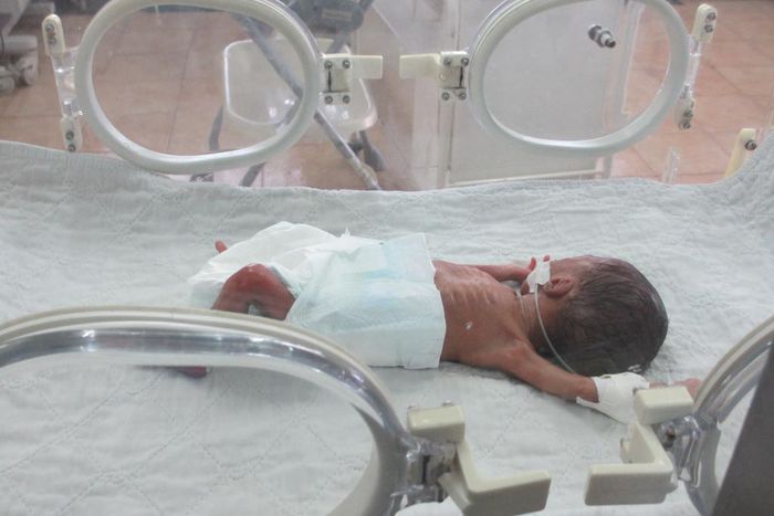 ___3773686___https:______static.pulse.com.gh___webservice___escenic___binary___3773686___2015___5___19___11___preemie-in-medshare-provided-incubator