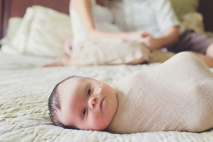 Baby Abigail born with an inoperable tumour and Down Syndrome captured by Mary Huszcza