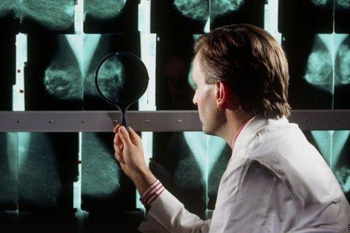 ___3961547___https:______static.pulse.com.gh___webservice___escenic___binary___3961547___2015___7___10___21____84156274_m4150291-doctor_examines_breast_mammograms_on_a_lightbox-spl