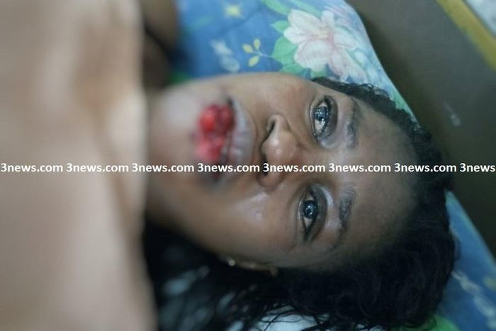Jealous girlfriend chews lip of suspected rival in Takoradi