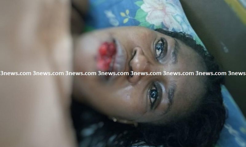 Jealous girlfriend chews lip of suspected rival in Takoradi