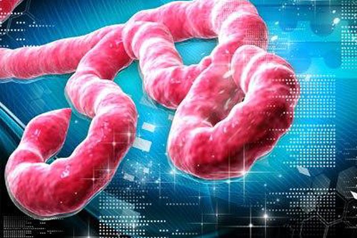 ___3850562___https:______static.pulse.com.gh___webservice___escenic___binary___3850562___2015___6___10___16___Ebola-Virus