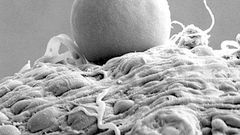 The microscopic image above (taken with an electron microscope) shows a bag of malaria parasites inside a mosquito. The bag contains between 5,000 and 20,000 parasites.