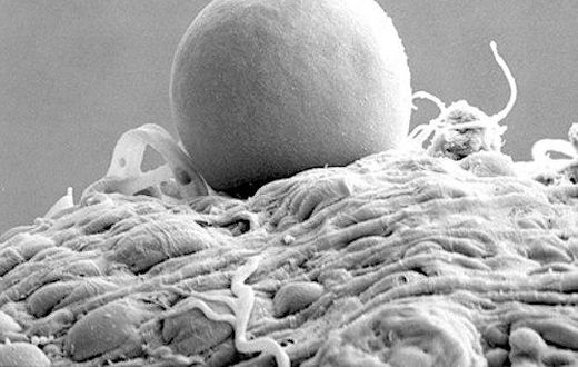 The microscopic image above (taken with an electron microscope) shows a bag of malaria parasites inside a mosquito. The bag contains between 5,000 and 20,000 parasites.