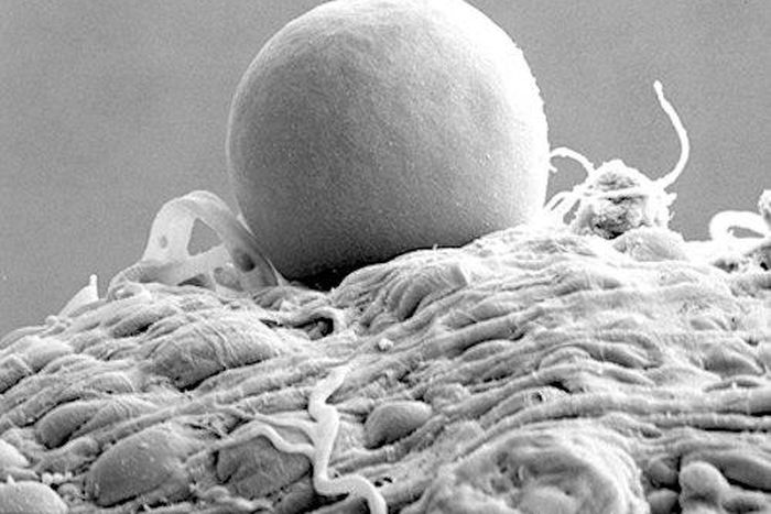 The microscopic image above (taken with an electron microscope) shows a bag of malaria parasites inside a mosquito. The bag contains between 5,000 and 20,000 parasites.