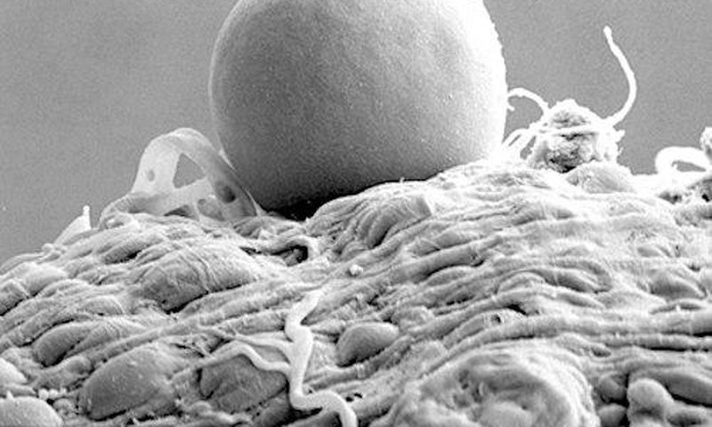 The microscopic image above (taken with an electron microscope) shows a bag of malaria parasites inside a mosquito. The bag contains between 5,000 and 20,000 parasites.