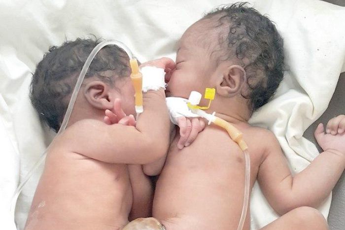 Just before the 6-hour separation of operation.