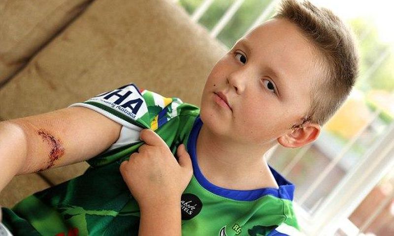 A 9-year-old boy needs plastic surgery after a neighbour's dog bit him on his arm.