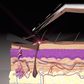 Animation showing how the Skarp Laser Razor works