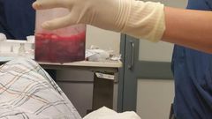 This amount of blood had to be extracted from his penis to relieve him.