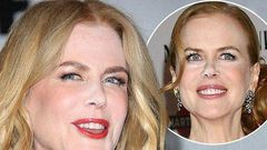 Nicole Kidman has a major beauty faux pas