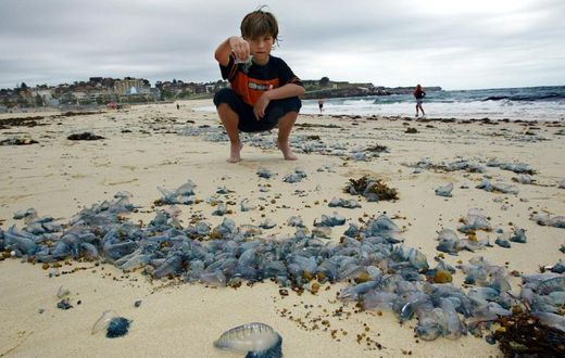Bluebottle stings are a frequent occurrence in Australia